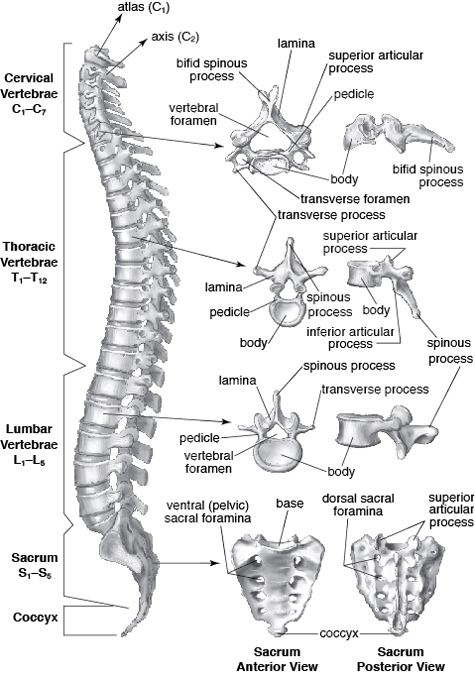 spinalstenosis